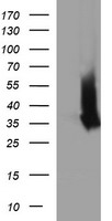 PIP3E (IPCEF1) antibody