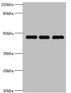 PIP4K2B Antibody