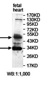 PIP4K2B antibody