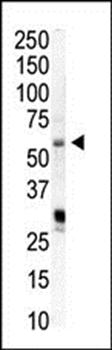 PIP5K1A antibody