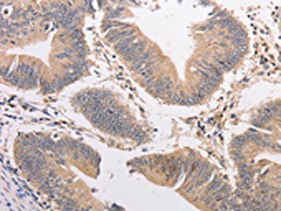 PIP5K1A Antibody