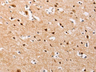 PIP5K1A Antibody