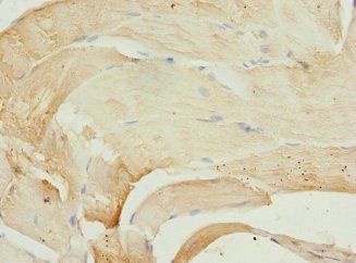 PIP5K1B Antibody