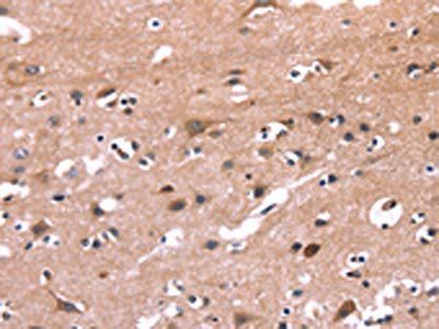 PIP5K1B Antibody