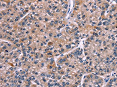 PIP5K1B Antibody
