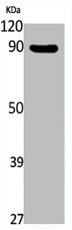 PIP5K1C antibody