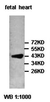 PIP5K2-beta antibody