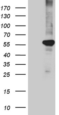 PIP5K3 (PIKFYVE) antibody