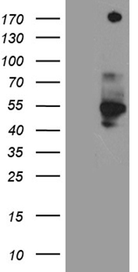 PIP5K3 (PIKFYVE) antibody