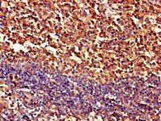 PIPOX Antibody