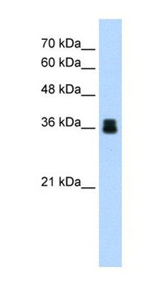 PIR antibody