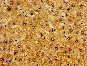 PIR Antibody
