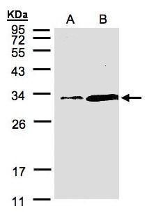 PITPN Rabbit Polyclonal Antibody