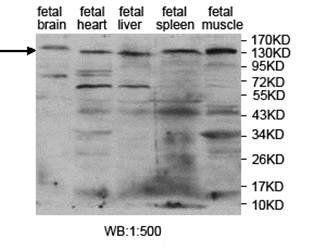 PITPNM2 antibody