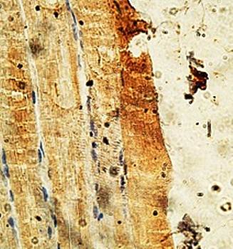 PITRM1 Rabbit Polyclonal Antibody