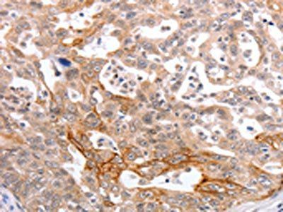 PIWIL1 Antibody