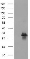 PKA R2 (PRKAR2A) antibody