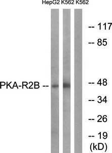 PKA-R2β (Ab-113) Antibody