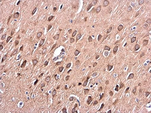 PKC alpha antibody