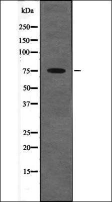PKC beta (Phospho-Thr514) antibody