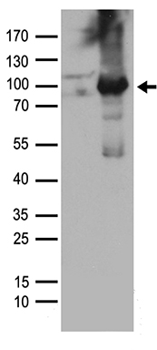 PKC delta (PRKCD) antibody