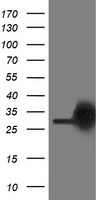 PKC epsilon (PRKCE) antibody