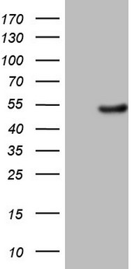 PKC nu (PRKD3) antibody