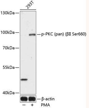 PKC (pan) (betaII Ser660) antibody