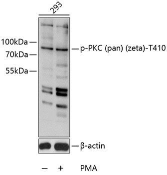 PKC (pan) (zeta) (Phospho-T410) antibody