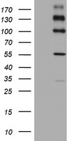 PKC zeta (PRKCZ) antibody