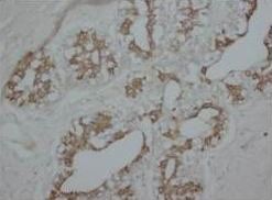 PKC alpha/PRKCA Antibody