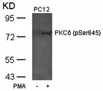 PKCδ (Phospho-Ser645) Antibody