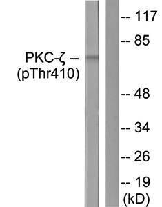 PKC zeta (phospho-Thr410) antibody