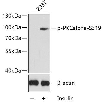 PKCalpha (Phospho-S319) antibody