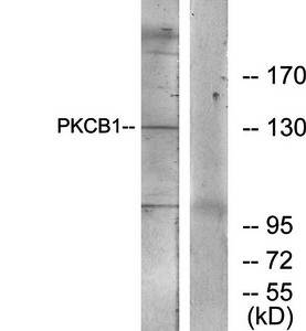 PKCB1 antibody