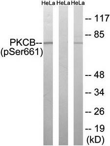 PKCB (phospho-Ser661) antibody