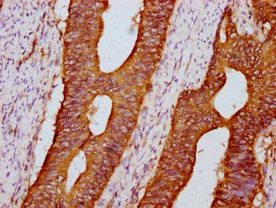 PKD1 Antibody