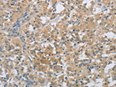 PKD1 antibody