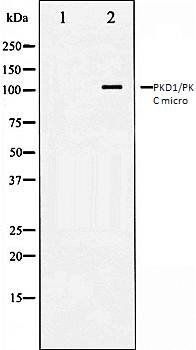 PKD1/PKC micro antibody