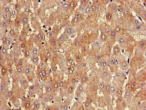 PKD1L1 Antibody