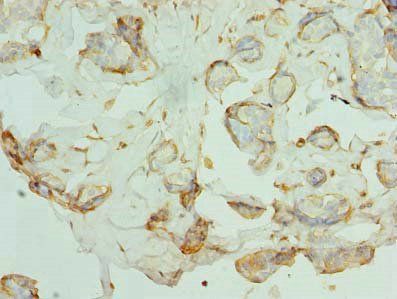 PKD1L2 Antibody