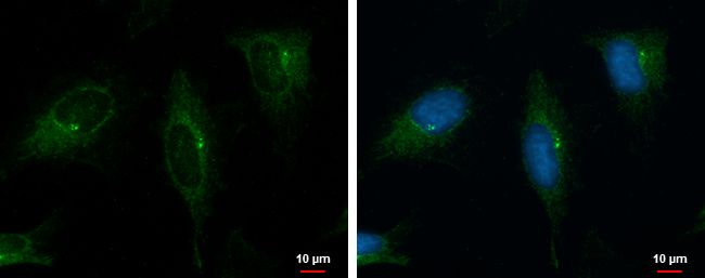 PKD2 antibody