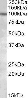 Goat anti-Polycystin 2 / PKD2 Antibody