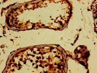 PKD2 Antibody