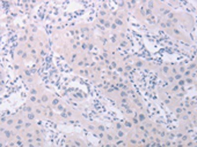 PKD2L1 Antibody