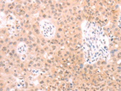 PKD2L1 antibody