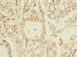 PKD2L2 Antibody