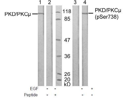 PKD/PKCμ (Phospho-Ser738) Antibody