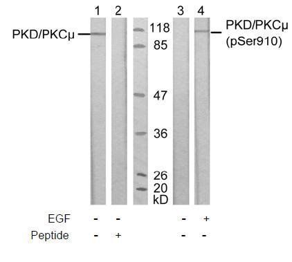 PKD/PKCμ (Phospho-Ser910) Antibody