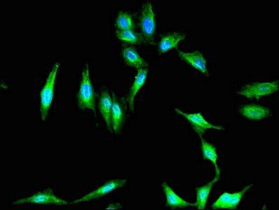 PKHD1 antibody